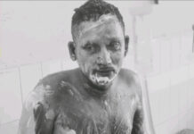 పెట్రోల్ పోసి నిప్పంటించిన ఘటన – వ్యక్తికి తీవ్ర గాయాలు