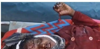 చౌడేపల్లిలో మహిళపై కొడవలితో నాగరాజు హత్యాయత్నం