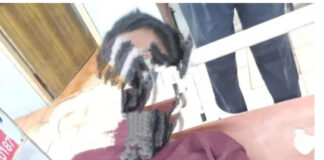 మదనపల్లిలో విషసర్పం కాటు.. ఆసుపత్రికి తరలింపు.