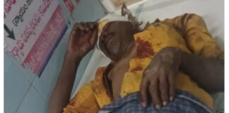 మదనపల్లి: స్కూటర్ ఢీకొని రైతుకు తీవ్ర గాయాలు.